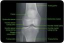 Anatomi Tubuh Manusia Sendi-lutut.thumbnail